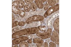 Immunohistochemical staining of human kidney with RNF7 polyclonal antibody  shows strong cytoplasmic positivity in cells in tubules at 1:20-1:50 dilution. (RNF7 anticorps)