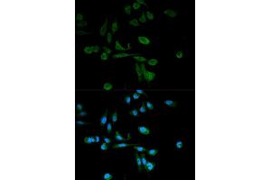 Immunofluorescence analysis of HeLa cell using SIRT7 antibody. (SIRT7 anticorps  (AA 201-400))