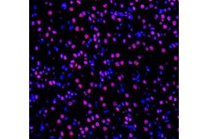 Immunofluorescence of paraffin embedded mouse kidney using GTF3C3 (ABIN7074039) at dilution of 1: 650 (400x lens)