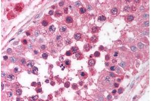 Human Testis (formalin-fixed, paraffin-embedded) stained with EGR4 antibody ABIN214101 at 5 ug/ml followed by biotinylated goat anti-rabbit IgG secondary antibody ABIN481713, alkaline phosphatase-streptavidin and chromogen.