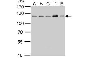 WB Image CYLD antibody detects CYLD protein by Western blot analysis. (CYLD anticorps  (C-Term))