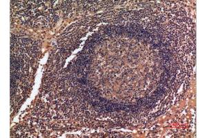 Immunohistochemistry (IHC) analysis of paraffin-embedded Human Lymph Gland, antibody was diluted at 1:100.