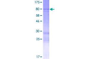 Image no. 1 for Lunapark, ER Junction Formation Factor (LNPK) (AA 1-428) protein (GST tag) (ABIN1308633)