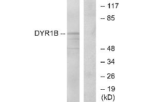 Western blot analysis of extracts from Jurkat cells, using DYR1B antibody. (DYRK1B anticorps)