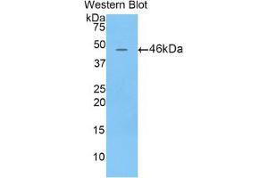 Western blot analysis of the recombinant protein. (Lipocalin 4 (LCN4) (AA 20-178) anticorps)