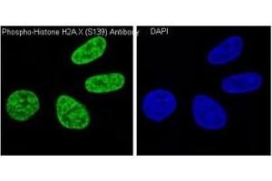 Immunofluorescent staining of human HeLa cells treated and untreated with H2O2 using phospho-Histone H2AX antibody (green) and DAPI nuclear stain (blue). (H2AFX anticorps  (pSer139))