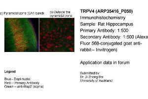 Immunohistochemistry (IHC) image for anti-Transient Receptor Potential Cation Channel, Subfamily V, Member 4 (TRPV4) (Middle Region) antibody (ABIN2776284) (TRPV4 anticorps  (Middle Region))