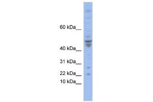 WB Suggested Anti-POLE4 Antibody Titration:  0. (POLE4 anticorps  (N-Term))