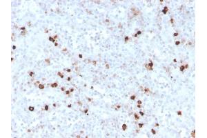 Formalin-fixed, paraffin-embedded human spleen stained with IgM Recombinant Rabbit Monoclonal Antibody (IGHM/3776R). (Recombinant IGHM anticorps)
