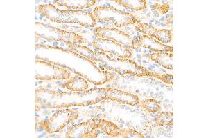 Immunohistochemistry analysis of paraffin-embedded rat kidney using,Cadherin 16 (ABIN7073265) at dilution of 1: 2000