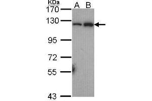WB Image Sample (30 ug of whole cell lysate) A: Hela B: Hep G2 , 7.