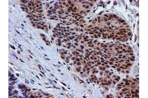 Image no. 10 for anti-Proteasome (Prosome, Macropain) 26S Subunit, Non-ATPase, 2 (PSMD2) antibody (ABIN1500479)