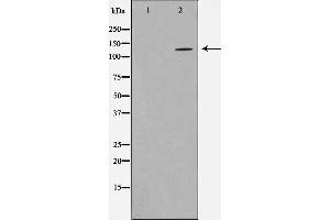 Western blot analysis on NIH-3T3 cell lysate using HDAC5 Antibody,The lane on the left is treated with the antigen-specific peptide.