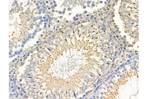 Phospho-Paxillin (Ser272) Antibody at 1/100 staining Rat testis tissue by IHC-P.
