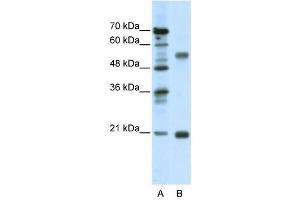 Western Blot showing CHRNB3 antibody used at a concentration of 1-2 ug/ml to detect its target protein. (CHRNB3 anticorps  (Middle Region))