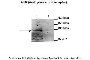 Lanes:   Lane1: 50 ug HepG2 nuclei extract + benzo[a]pyrene Lane2: 50 ug HepG2 cytoplasm extract + benzo[a]pyrene  Primary Antibody Dilution:   1:1000  Secondary Antibody:   Anti-rabbit HRP  Secondary Antibody Dilution:   1:1000  Gene Name:   AHR (Arylhydrocarbon receptor)  Submitted by:   Anonymous