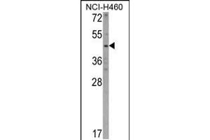 Western blot analysis of KYNU Antibody in NCI-H460 cell line lysates (35ug/lane) (KYNU anticorps  (C-Term))