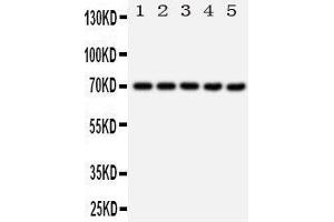 Western Blotting (WB) image for anti-Heat Shock 70kDa Protein 1A (HSPA1A) (AA 577-596), (C-Term) antibody (ABIN3044190) (HSP70 1A anticorps  (C-Term))