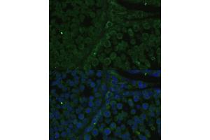 Immunofluorescence analysis of rat testis cells using IGF2BP2/IMP2 antibody (ABIN6131799, ABIN6142242, ABIN6142244 and ABIN6218878) at dilution of 1:100.