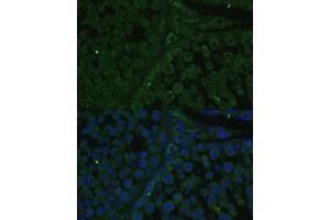 Immunofluorescence analysis of rat testis cells using IGF2BP2/IMP2 antibody (ABIN6131799, ABIN6142242, ABIN6142244 and ABIN6218878) at dilution of 1:100. (IGF2BP2 anticorps  (AA 330-599))