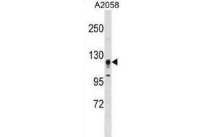 Western Blotting (WB) image for anti-serine/threonine Kinase 31 (STK31) antibody (ABIN3003073) (STK31 anticorps)