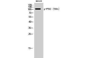 Western Blotting (WB) image for anti-PTK2B Protein tyrosine Kinase 2 beta (PTK2B) (pTyr881) antibody (ABIN3182495)