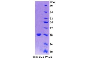 SDS-PAGE analysis of Rat PAX6 Protein. (PAX6 Protéine)