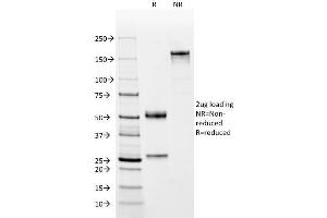 SDS-PAGE Analysis Purified Complement 4d Mouse Monoclonal Antibody (C4D204). (C4A anticorps)