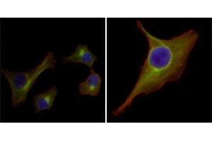 Immunofluorescence analysis of HepG2(left) and PACN-1 (right) cells using KRT15 mouse mAb (green).