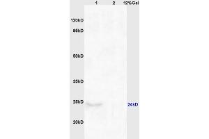 Lane 1: mouse brain lysates Lane 2: mouse kidney lysates probed with Anti CHAC1 Polyclonal Antibody, Unconjugated (ABIN872557) at 1:200 in 4 °C.