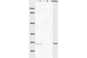 Lane 1: mouse brain lysates Lane 2: mouse kidney lysates probed with Anti CHAC1 Polyclonal Antibody, Unconjugated (ABIN872557) at 1:200 in 4 °C. (CHAC1 anticorps  (AA 131-222))