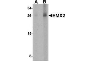 Western blot analysis of EMX2 in human lung tissue lysate with EMX2 Antibody at (A) 1 and (B) 2 µg/ml. (EMX2 anticorps  (Middle Region))
