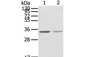 Western Blot analysis of NIH/3T3 and Jurkat cell using RACK1 Polyclonal Antibody at dilution of 1:300 (GNB2L1 anticorps)