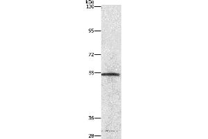 Western blot analysis of Lovo cell, using NEK2 Polyclonal Antibody at dilution of 1:727 (NEK2 anticorps)
