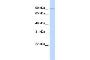 WB Suggested Anti-ZNF226 Antibody Titration:  0. (ZNF226 anticorps  (N-Term))