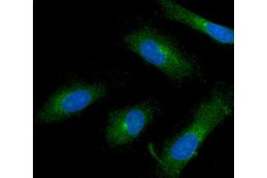 ICC/IF analysis of ISG15 in HeLa cells line, stained with DAPI (Blue) for nucleus staining and monoclonal anti-human ISG15 antibody (1:100) with goat anti-mouse IgG-Alexa fluor 488 conjugate (Green).