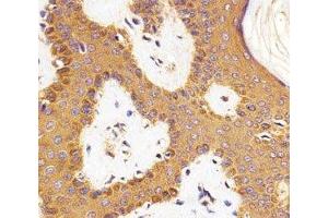 Immunohistochemical analysis of paraffin-embedded human skin section using RAC1 antibody at 1:25 dilution.
