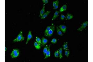 Immunofluorescent analysis of HepG2 cells using ABIN7150873 at dilution of 1:100 and Alexa Fluor 488-congugated AffiniPure Goat Anti-Rabbit IgG(H+L)