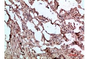 Immunohistochemical analysis of paraffin-embedded human-lung, antibody was diluted at 1:200. (GDF2 anticorps  (AA 371-420))