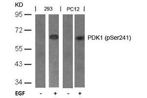 Western blot analysis of extracts from 293 and PC12 cells untreated or treated with EGF using PDK1(Phospho-Ser241) Antibody. (PDPK1 anticorps  (pSer241))