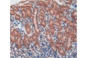 Used in DAB staining on fromalin fixed paraffin- embedded kidney tissue (Talin anticorps  (AA 975-1181))