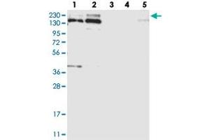 Western blot analysis of Lane 1: RT-4, Lane 2: U-251 MG, Lane 3: Human Plasma, Lane 4: Liver, Lane 5: Tonsil with SNRNP200 polyclonal antibody  at 1:250-1:500 dilution. (SNRNP200 anticorps)