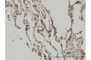 Image no. 1 for anti-NF-kappa-B inhibitor beta (NFKBIB) (AA 56-145) antibody (ABIN598839) (NFKBIB anticorps  (AA 56-145))