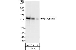 Western Blotting (WB) image for anti-General Transcription Factor III (GTF2I) (AA 935-985) antibody (ABIN7454739)
