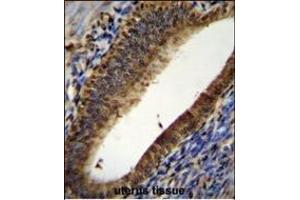 PT Antibody (N-term) (ABIN655715 and ABIN2845165) immunohistochemistry analysis in forlin fixed and paraffin embedded hun uterus tissue followed by peroxidase conjugation of the secondary antibody and DAB staining. (PTMA anticorps  (N-Term))