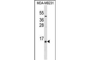 Western blot analysis in MDA-MB231 cell line lysates (35ug/lane). (LST1 anticorps  (AA 19-47))