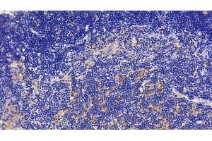 Detection of IL1RAP in Rat Thymus Tissue using Polyclonal Antibody to Interleukin 1 Receptor Accessory Protein (IL1RAP)