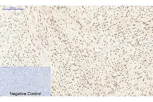anti-Peroxisome Proliferator-Activated Receptor delta (PPARD) antibody