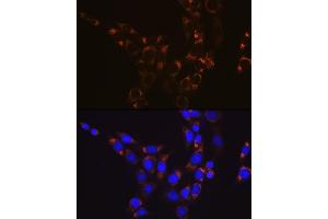 Immunofluorescence analysis of NIH-3T3 cells using GLUD1 Rabbit mAb (ABIN7267411) at dilution of 1:100 (40x lens).