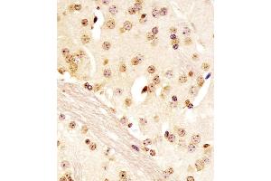 (ABIN6243925 and ABIN6578096) staining (Mouse) Pou5f1 in mouse brain sections by Immunohistochemistry (IHC-P - paraformaldehyde-fixed, paraffin-embedded sections). (OCT4 anticorps  (N-Term))